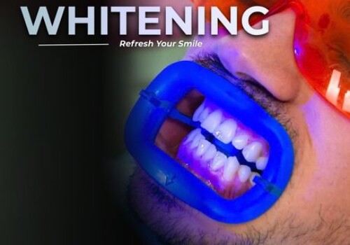 Whitening