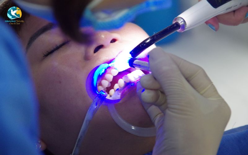 Teeth whitening for brighter results