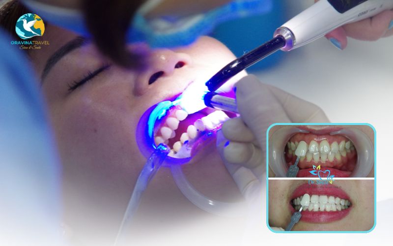 Balance between health and leisure