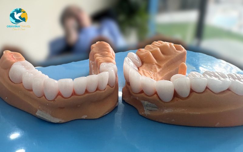 Use of imported dental materials from reputable global brands