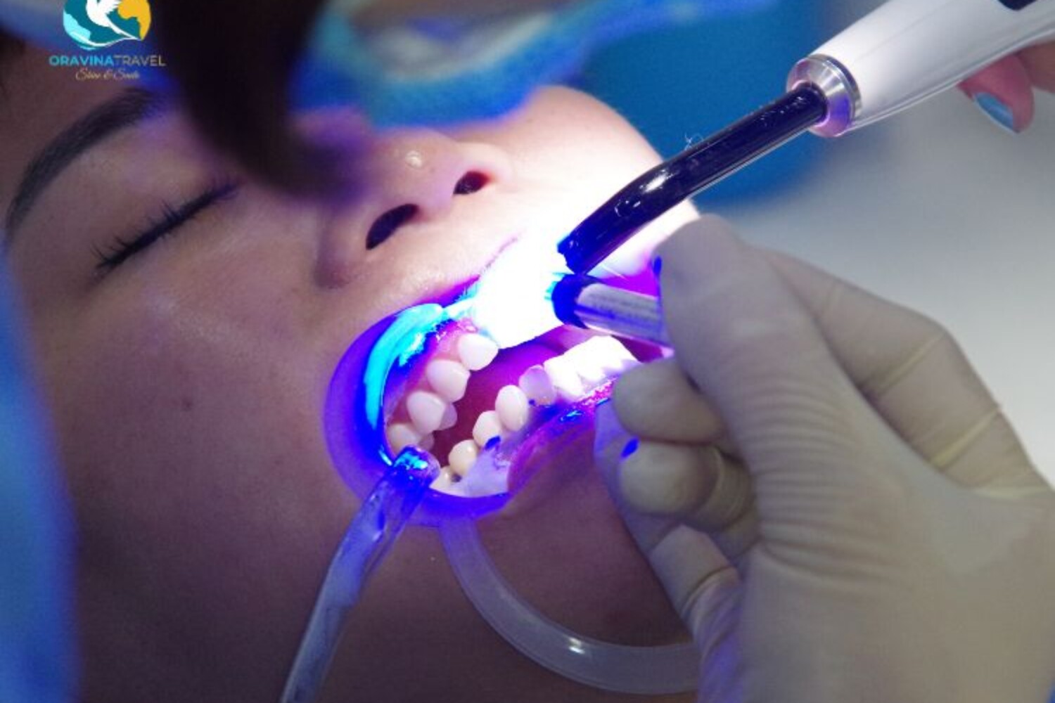 Teeth whitening dental tour Vietnam