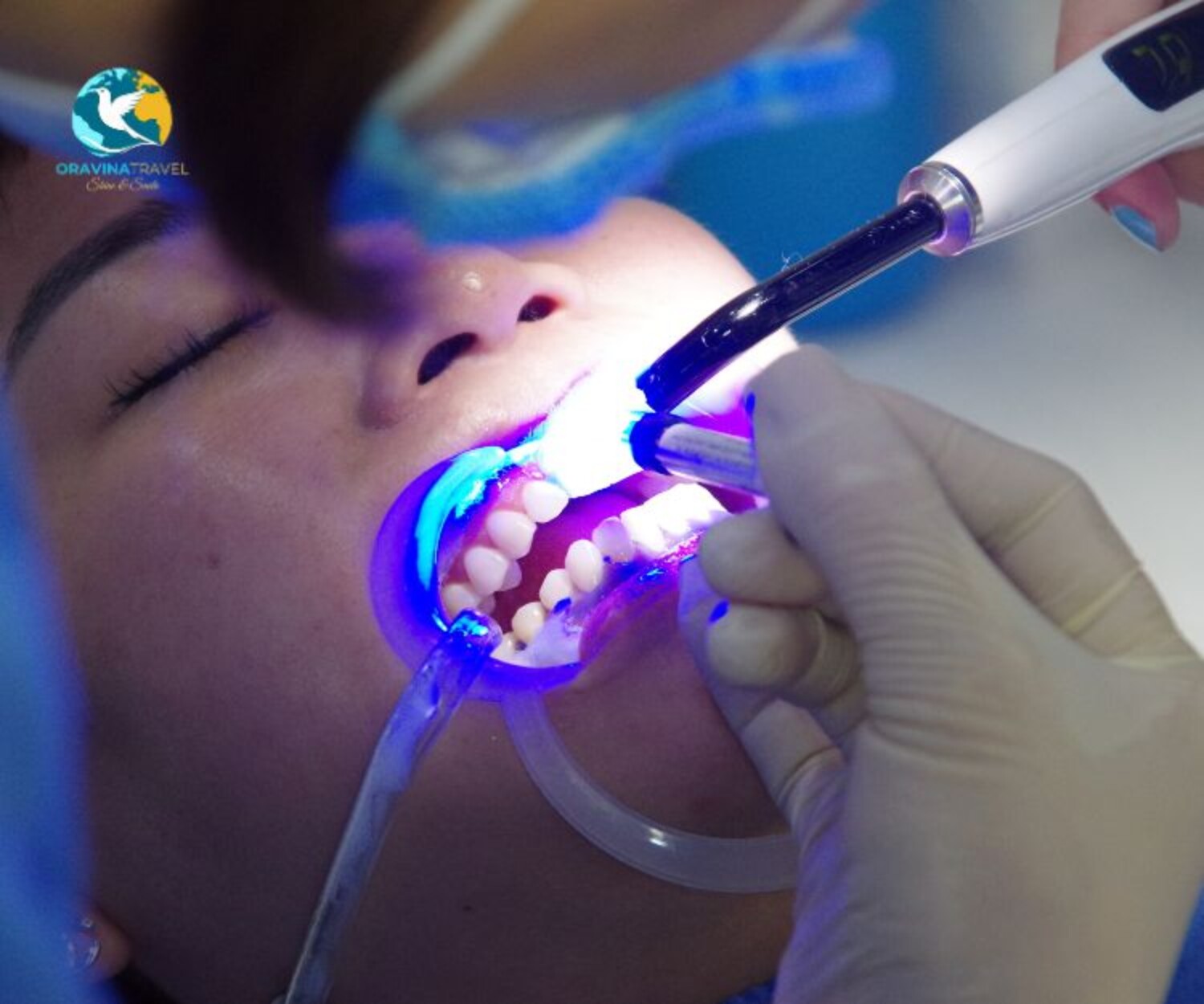 Teeth whitening dental tour Vietnam