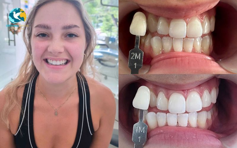 This discomfort is only a mild tingling sensation